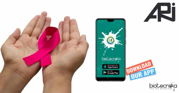 Breast Cancer Research Job