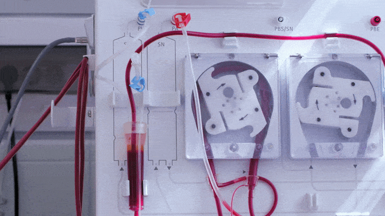 Solution To Global Blood Shortage