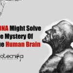 What Makes Human Brain Unique?