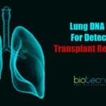 Lung DNA Test To Track Progression Of Organ Transplants Lung DNA Test