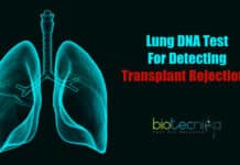 Lung DNA Test