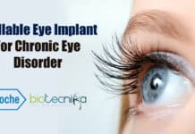 Refillable Eye Implant For Chronic Eye Disorder From Roche Roche's eye implant