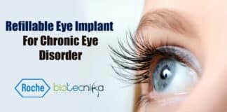 Roche's eye implant