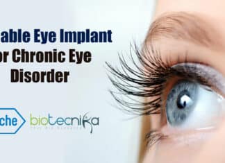 Roche's eye implant