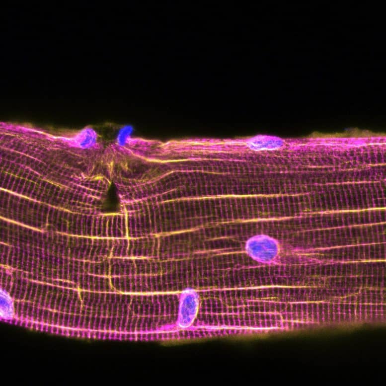 Muscle Regeneration after physiological damage
