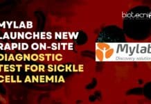 Mylab Sickle Cell Anemia