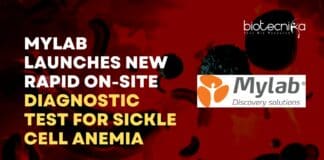 Mylab Sickle Cell Anemia