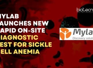 Mylab Sickle Cell Anemia