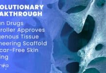 Indigenous Tissue Engineering Scaffold