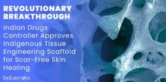 Indigenous Tissue Engineering Scaffold
