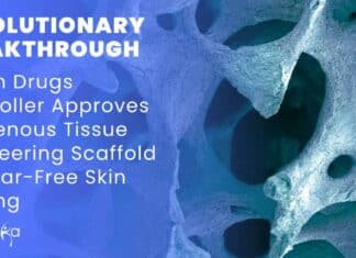 Indigenous Tissue Engineering Scaffold