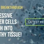 Cancer Cells Morph Into Healthy