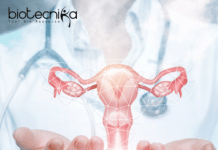 Stay Informed: Discovered the Top 5 Breakthroughs in Ovarian Cancer Research from the Last Year! Ovarian cancer