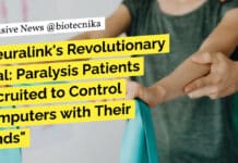 “Neuralink’s Revolutionary Trial: Paralysis Patients Recruited to Control Computers with Their Minds” "Neuralink's Revolutionary Trial: Paralysis Patients Recruited to Control Computers with Their Minds"
