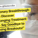 "Revolutionary Breakthrough: Scientists Discover Game-Changing Treatment for Acne - Say Goodbye to Embarrassing Breakouts!"