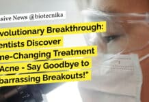"Revolutionary Breakthrough: Scientists Discover Game-Changing Treatment for Acne - Say Goodbye to Embarrassing Breakouts!"