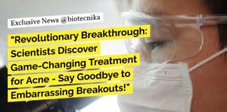 "Revolutionary Breakthrough: Scientists Discover Game-Changing Treatment for Acne - Say Goodbye to Embarrassing Breakouts!"