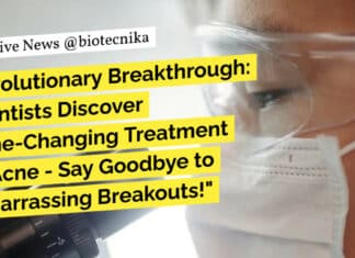 "Revolutionary Breakthrough: Scientists Discover Game-Changing Treatment for Acne - Say Goodbye to Embarrassing Breakouts!"