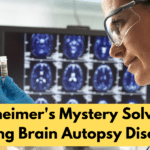 Alzheimer’s Mystery Solved? Surprising Brain Autopsy Discoveries! microglia