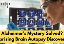 Alzheimer’s Mystery Solved? Surprising Brain Autopsy Discoveries! microglia