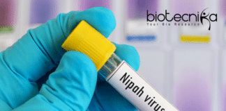 The Nipah Virus Outbreak in Kerala