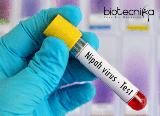 The Nipah Virus Outbreak in Kerala