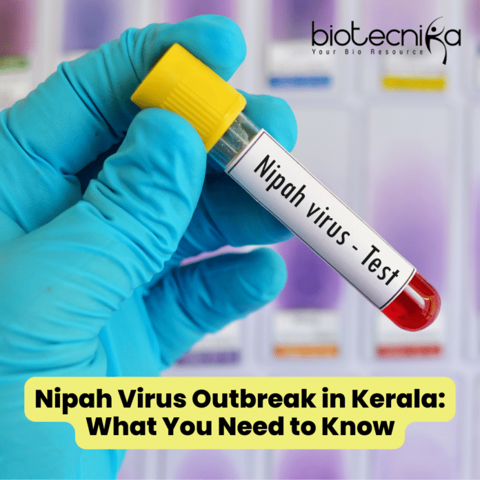 The Nipah Virus Outbreak in Kerala