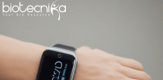 smartwatch wristbands