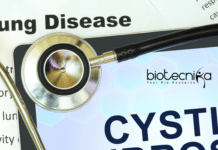Cystic Fibrosis Game-Changer: US$3-Million Prize Unleashes Hope for Millions! Cystic fibrosis