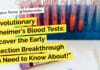 “Revolutionary Alzheimer’s Blood Tests: Discover the Early Detection Breakthrough You Need to Know About!” "Revolutionary Alzheimer's Blood Tests: Discover the Early Detection Breakthrough You Need to Know About!"