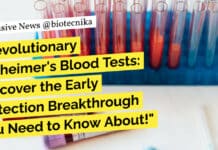 “Revolutionary Alzheimer’s Blood Tests: Discover the Early Detection Breakthrough You Need to Know About!” "Revolutionary Alzheimer's Blood Tests: Discover the Early Detection Breakthrough You Need to Know About!"