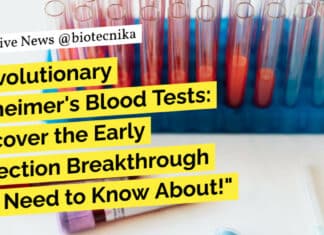 "Revolutionary Alzheimer's Blood Tests: Discover the Early Detection Breakthrough You Need to Know About!"