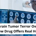 Brain Tumor Terror Over: New Drug Offers Real Hope! Brain Tumor