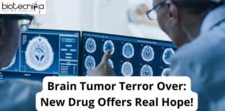 Brain Tumor