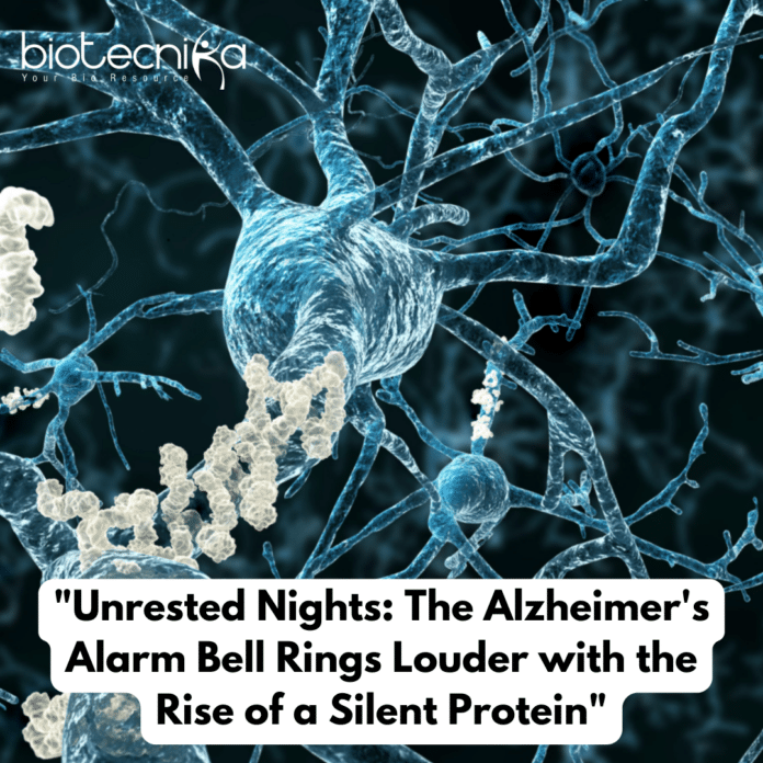 Alzheimer's Risk Factor