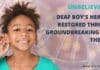 Unbelievable! Deaf Boy’s Hearing Restored through Groundbreaking Gene Therapy: Hope for Everyone Suffering from Hearing Loss Groundbreaking Gene Therapy Restores