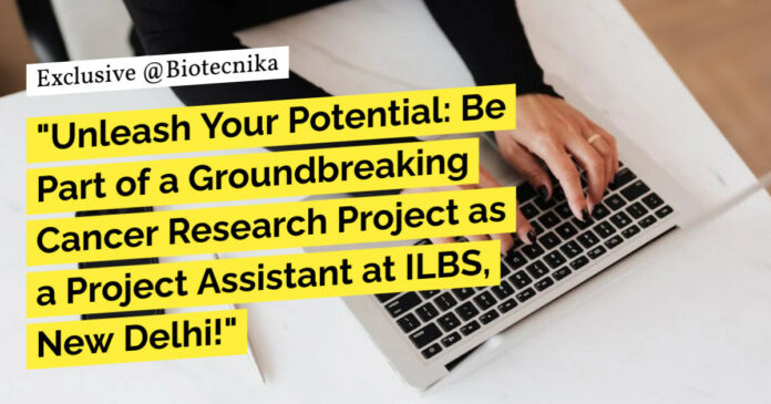Govt ILBS Delhi Project Job