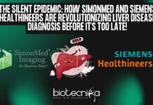 Ultrasound Liver Disease Diagnosis by SimonMed and Siemens Healthineers