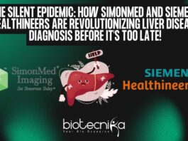 Ultrasound Liver Disease Diagnosis by SimonMed and Siemens Healthineers