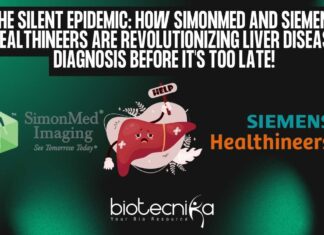 Ultrasound Liver Disease Diagnosis by SimonMed and Siemens Healthineers