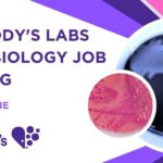 Dr. Reddy's Labs Microbiology Job