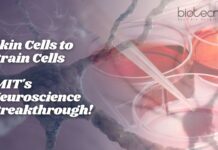 Skin Cells to Brain Cells