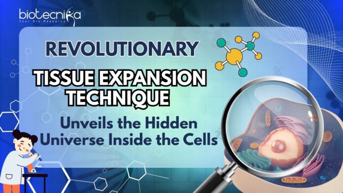 Revolutionary Tissue Expansion Technique Unveils the Hidden Universe Inside Cells