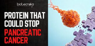 Breakthrough In Pancreatic Cancer. Cancer-Causing Protein Found