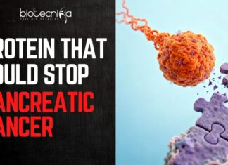 Breakthrough In Pancreatic Cancer. Cancer-Causing Protein Found