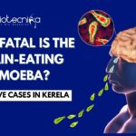 Everything you need to know about the fatal Brain-Eating Amoeba Everything you need to know about the fatal Brain-Eating Amoeba