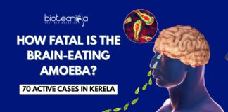 Everything you need to know about the fatal Brain-Eating Amoeba 