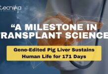 Liver Transplant: A Breakthrough in Medicine
