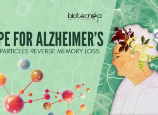 Hope For Alzheimer’s: Nanoparticles Reverse Memory Loss Nanoparticles for Alzheimer’s treatment - Can This Reverse Memory Loss?
