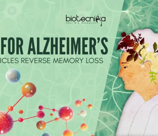 Nanoparticles for Alzheimer’s treatment - Can This Reverse Memory Loss?